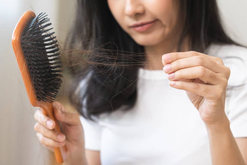 What are the Common Causes of Hair Loss in Both Men and Women