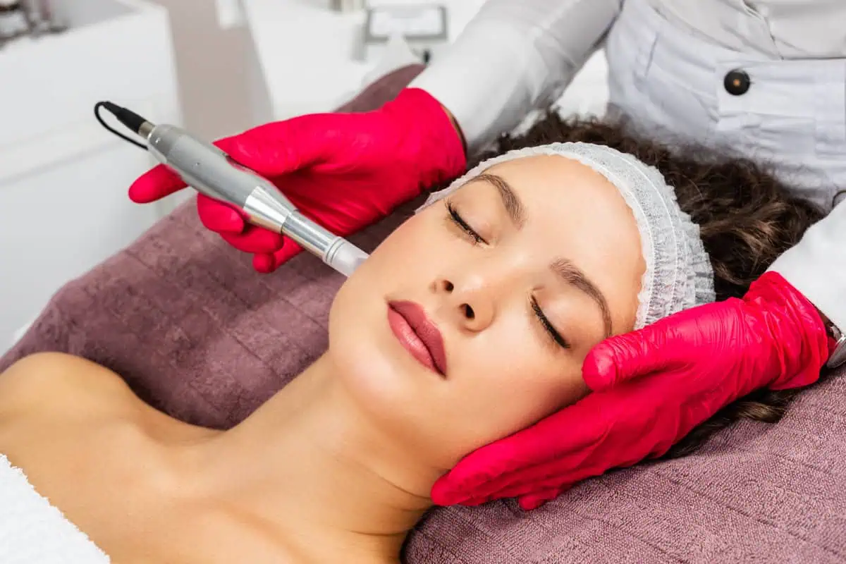 Beautiful woman receiving microneedling rejuvenation treatment in Rejuve Wellness and Aesthetics.