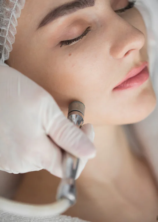 Dermaplaning treatment being performed on a client's face at Rejuve Med Spa