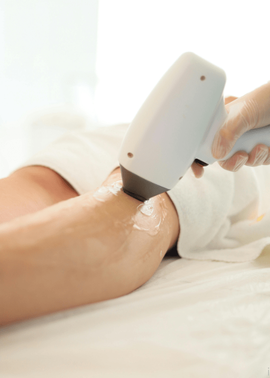 laser hair removal