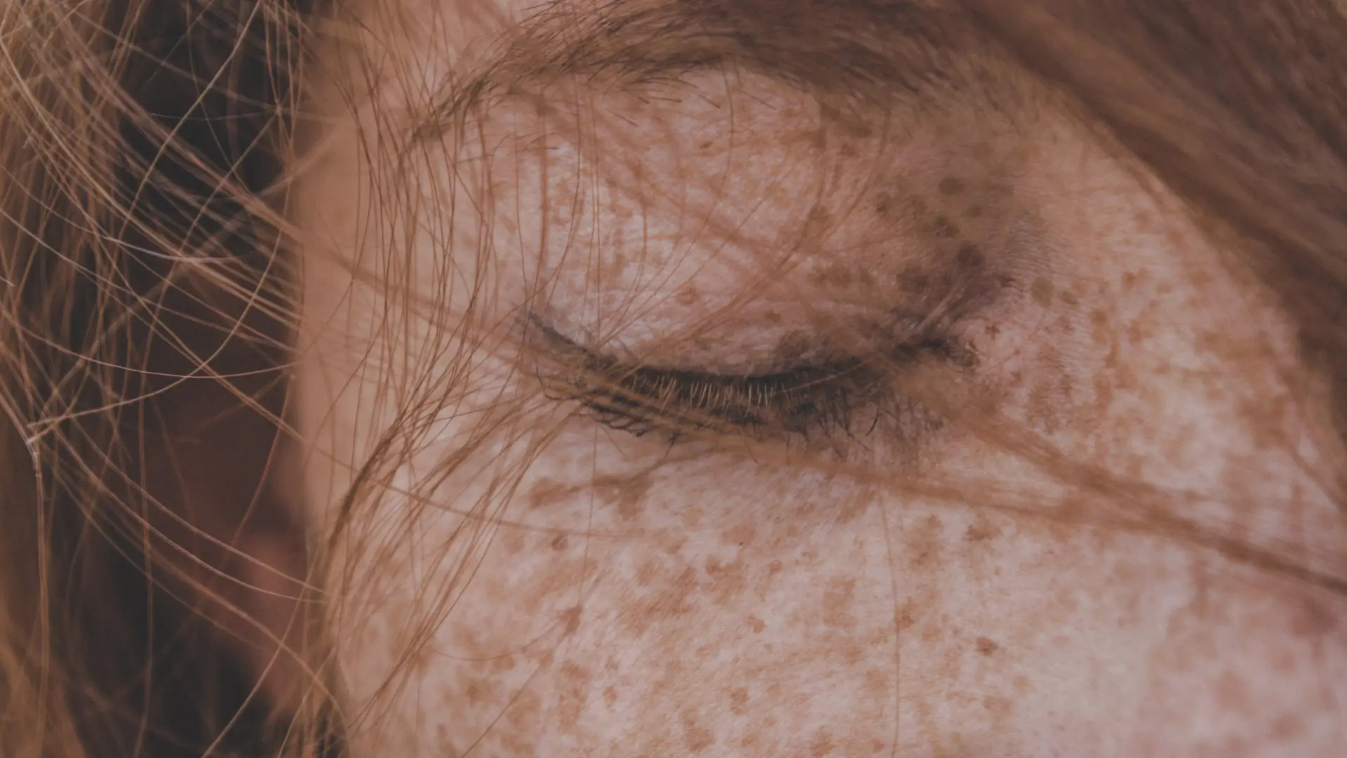 Crepey Eyelid Skin Making You Look Tired_ How Tixel Treats the Delicate Eye Area